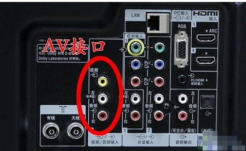 广电网络机顶盒的区别、